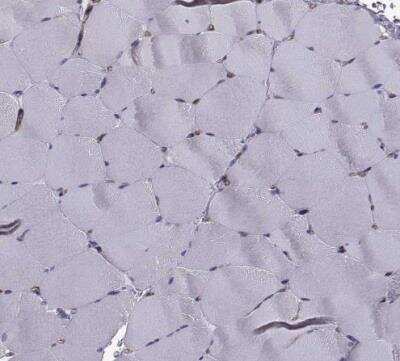 Immunohistochemistry-Paraffin: non-muscle Myosin IIA Antibody [NBP1-85244]