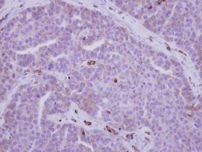 Immunohistochemistry-Paraffin: non-muscle Myosin IIA Antibody [NBP2-19563]
