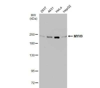 Western Blot: non-muscle Myosin IIA Antibody [NBP2-19563]