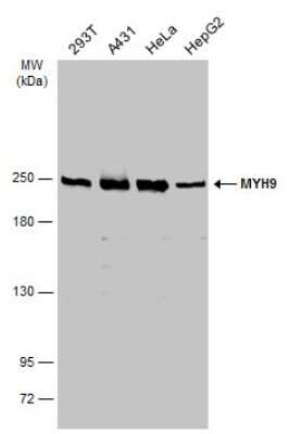 Western Blot: non-muscle Myosin IIA Antibody [NBP3-13220]
