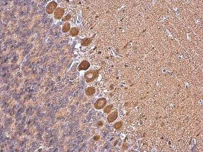 Immunohistochemistry-Paraffin: non-muscle heavy chain 10 Myosin Antibody (GT246) [NBP3-13591]