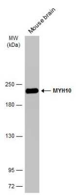 Western Blot: non-muscle heavy chain 10 Myosin Antibody (GT246) [NBP3-13591]