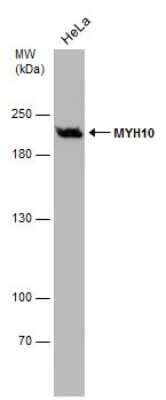 Western Blot: non-muscle heavy chain 10 Myosin Antibody (GT246) [NBP3-13591]