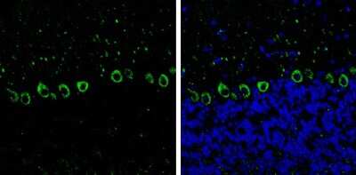 Immunohistochemistry-Frozen: non-muscle heavy chain 10 Myosin Antibody (GT324) [NBP3-13583]