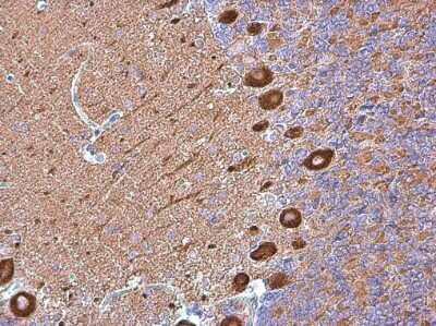 Immunohistochemistry-Paraffin: non-muscle heavy chain 10 Myosin Antibody (GT324) [NBP3-13583]