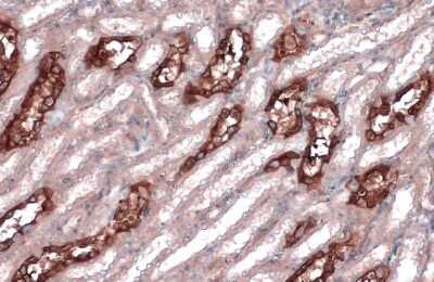 Immunohistochemistry-Paraffin: non-muscle heavy chain 10 Myosin Antibody (GT324) [NBP3-13583]