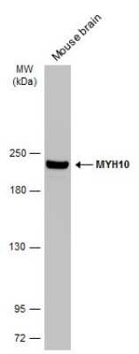 Western Blot: non-muscle heavy chain 10 Myosin Antibody (GT324) [NBP3-13583]