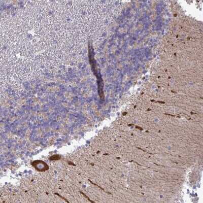 Immunohistochemistry: non-muscle heavy chain 10 Myosin Antibody [NBP2-38824]