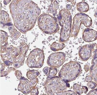 Immunohistochemistry-Paraffin: non-muscle heavy chain 10 Myosin Antibody [NBP2-38566]
