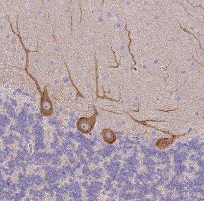 Immunohistochemistry-Paraffin: non-muscle heavy chain 10 Myosin Antibody [NBP2-38566]
