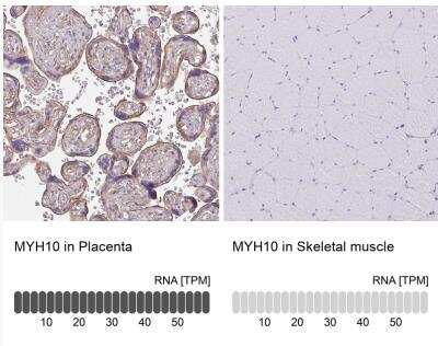 Immunohistochemistry-Paraffin: non-muscle heavy chain 10 Myosin Antibody [NBP2-38566]