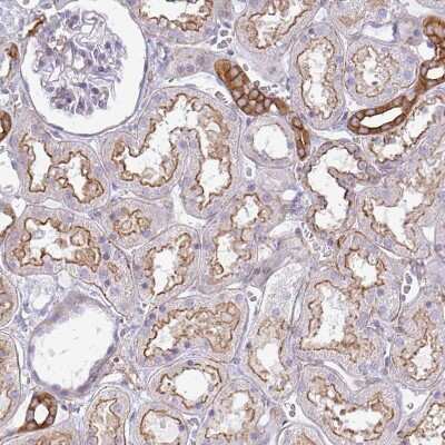 Immunohistochemistry-Paraffin: non-muscle heavy chain 10 Myosin Antibody [NBP2-38566]