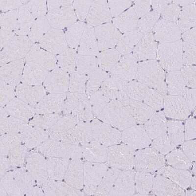 Immunohistochemistry-Paraffin: non-muscle heavy chain 10 Myosin Antibody [NBP2-38566]