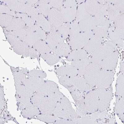 Immunohistochemistry-Paraffin: non-muscle heavy chain 10 Myosin Antibody [NBP2-38824]