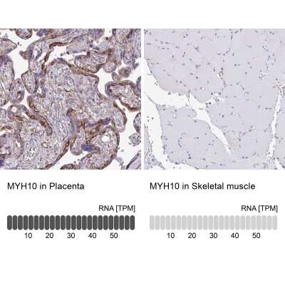 Immunohistochemistry-Paraffin: non-muscle heavy chain 10 Myosin Antibody [NBP2-38824]