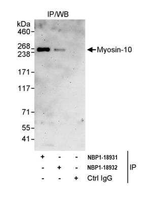 Immunoprecipitation: non-muscle heavy chain 10 Myosin Antibody [NBP1-18931]