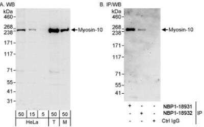 Western Blot: non-muscle heavy chain 10 Myosin Antibody [NBP1-18932]