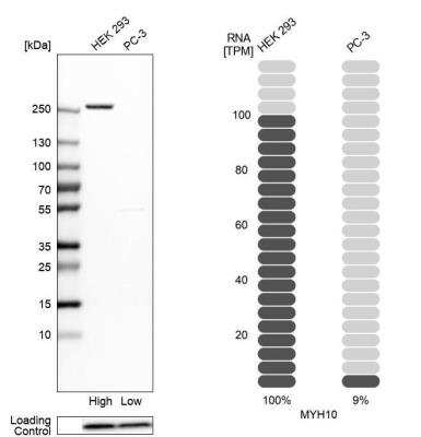 Western Blot: non-muscle heavy chain 10 Myosin Antibody [NBP2-38566]