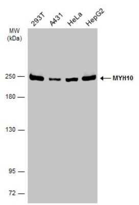 Western Blot: non-muscle heavy chain 10 Myosin Antibody [NBP3-13221]