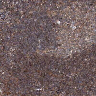 Immunohistochemistry-Paraffin: noxin Antibody [NBP2-48685]