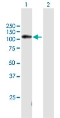 Western Blot: noxin Antibody [H00220042-B02P]