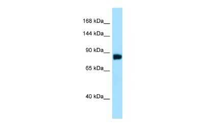 Western Blot: noxin Antibody [NBP2-87937]