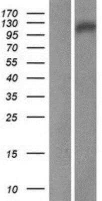 Western Blot: noxin Overexpression Lysate [NBP2-05512]