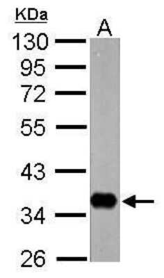 Western Blot: nrv1 Antibody [NBP2-42889]