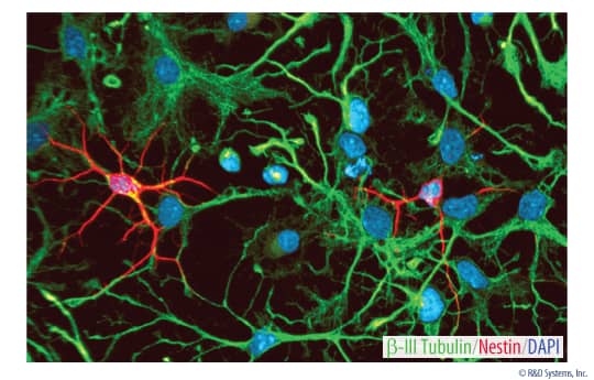 Differentiation of Rat Cortical Stem Cells