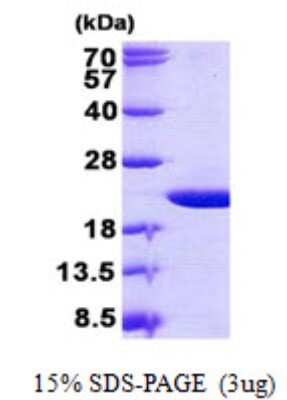 SDS-PAGE: Recombinant Human Olfactory Marker Protein His Protein [NBP2-23307]