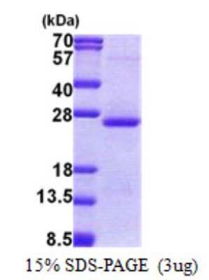 SDS-PAGE: Recombinant Human Orosomucoid 2 His Protein [NBP2-23311]