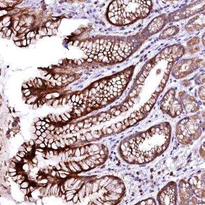 Immunohistochemistry: ovochymase-1 Antibody [NBP1-90682]