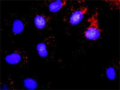 Proximity Ligation Assay: p107 Antibody (1A5) [H00005933-M01]