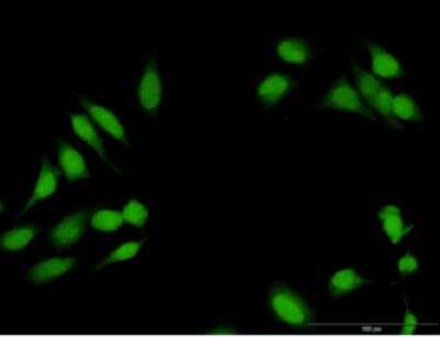 Immunocytochemistry/ Immunofluorescence: p107 Antibody [H00005933-B01P-50ug]