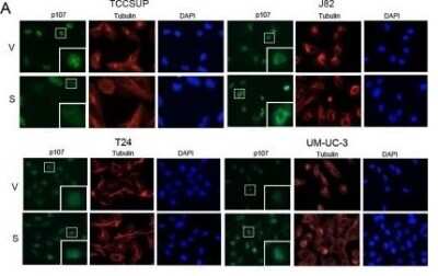Immunocytochemistry/ Immunofluorescence: p107 Antibody [NBP2-33735]