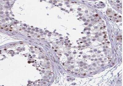 Immunohistochemistry-Paraffin: p107 Antibody [NBP2-33735]