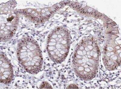 Immunohistochemistry-Paraffin: p107 Antibody [NBP2-33735]