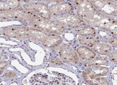 Immunohistochemistry-Paraffin: p107 Antibody [NBP2-33735]