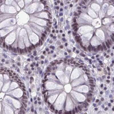 Immunohistochemistry-Paraffin: p107 Antibody [NBP2-33791]