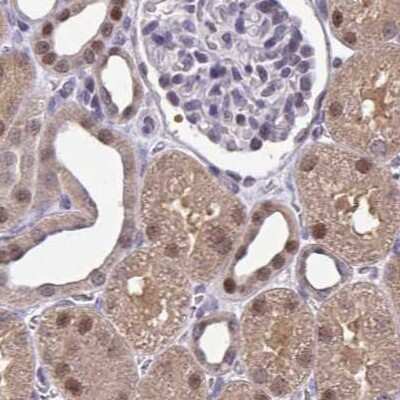 Immunohistochemistry-Paraffin: p107 Antibody [NBP2-33791]