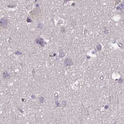Immunohistochemistry-Paraffin: p107 Antibody [NBP2-33791]