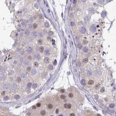 Immunohistochemistry-Paraffin: p107 Antibody [NBP2-33791]