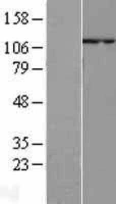 Western Blot: p107 Overexpression Lysate [NBL1-15192]