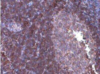 Immunohistochemistry-Paraffin: p114RhoGEF Antibody (1972) [NBP2-43546]
