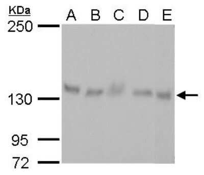 Western Blot: p114RhoGEF Antibody (1972) [NBP2-43546]
