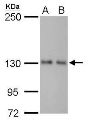 Western Blot: p114RhoGEF Antibody (1972) [NBP2-43546]