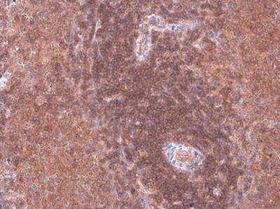 Immunohistochemistry-Paraffin: p114RhoGEF Antibody [NBP1-32816]