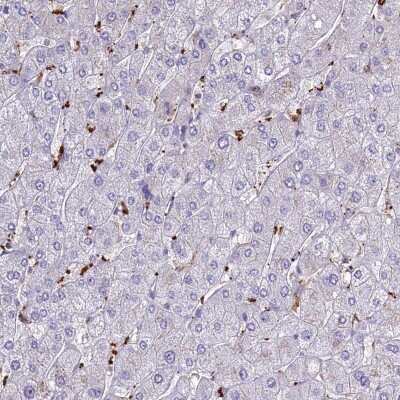 Immunohistochemistry-Paraffin: p114RhoGEF Antibody [NBP1-92238]