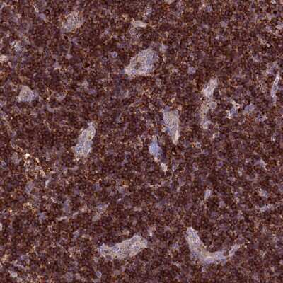 Immunohistochemistry-Paraffin: p114RhoGEF Antibody [NBP1-92238]