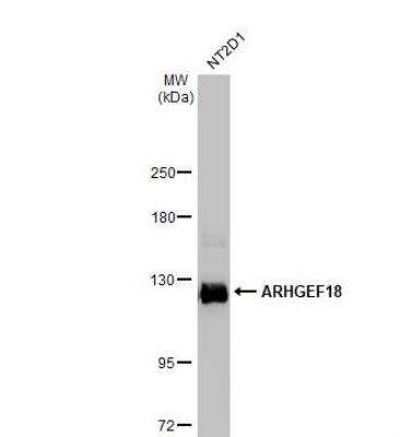 Western Blot: p114RhoGEF Antibody [NBP1-32816]